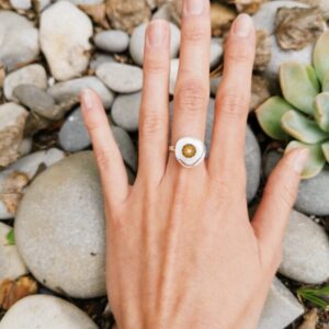 Miniature Sea Urchin Ring